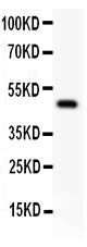 1 - Anti-AP2 Alpha Picoband Antibody ABO11821