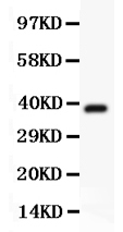 1 - Anti-Hamartin Picoband Antibody ABO11822