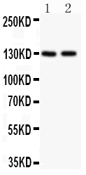 1 - Anti-Hamartin Picoband Antibody ABO11822