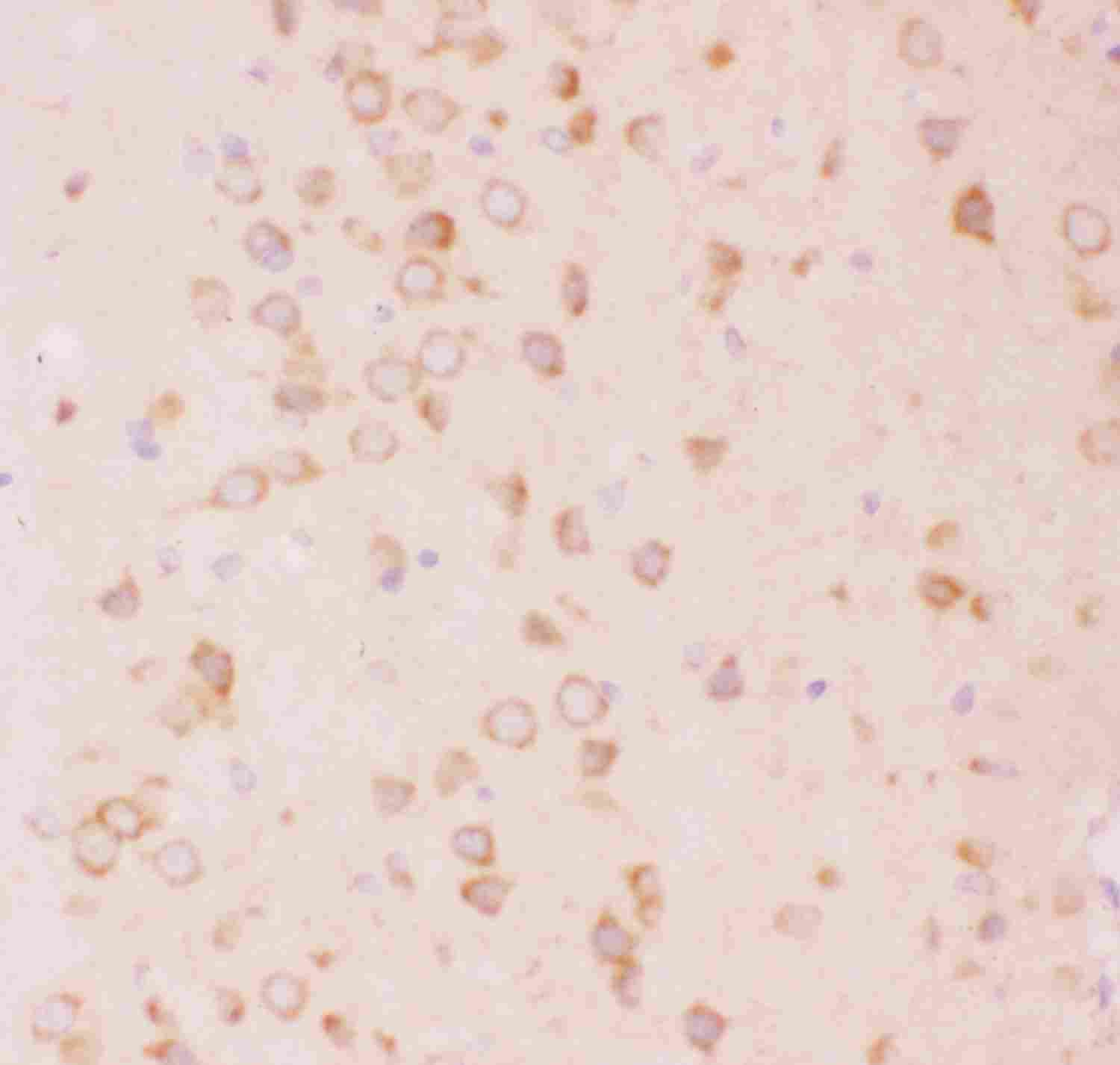 2 - Anti-Tuberin Picoband Antibody ABO11823