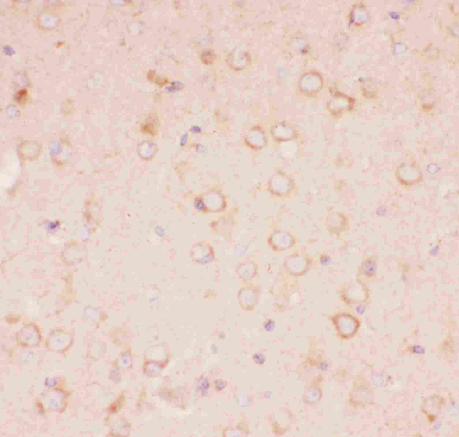 2 - Anti-Tuberin Picoband Antibody ABO11823