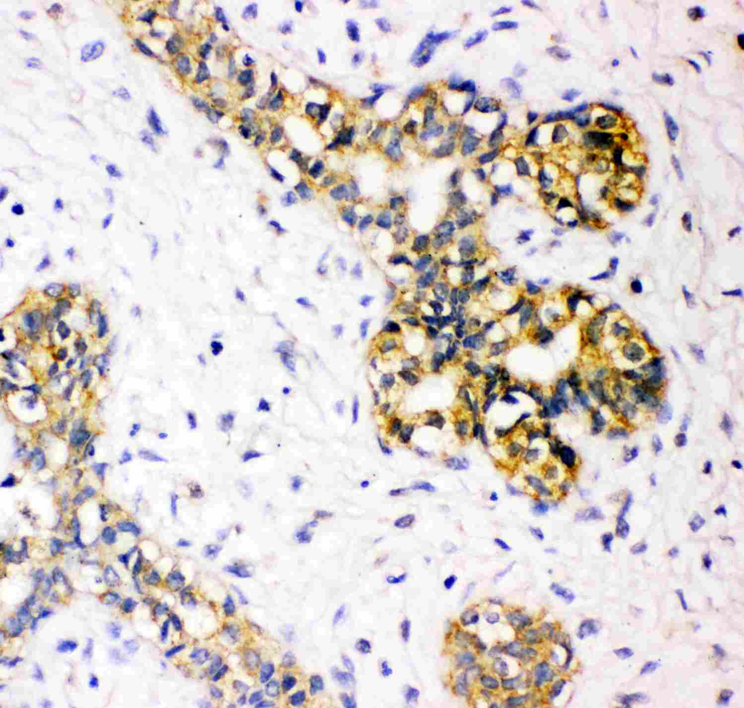 2 - Anti-Tuberin Picoband Antibody ABO11823