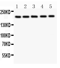 1 - Anti-Tuberin Picoband Antibody ABO11823