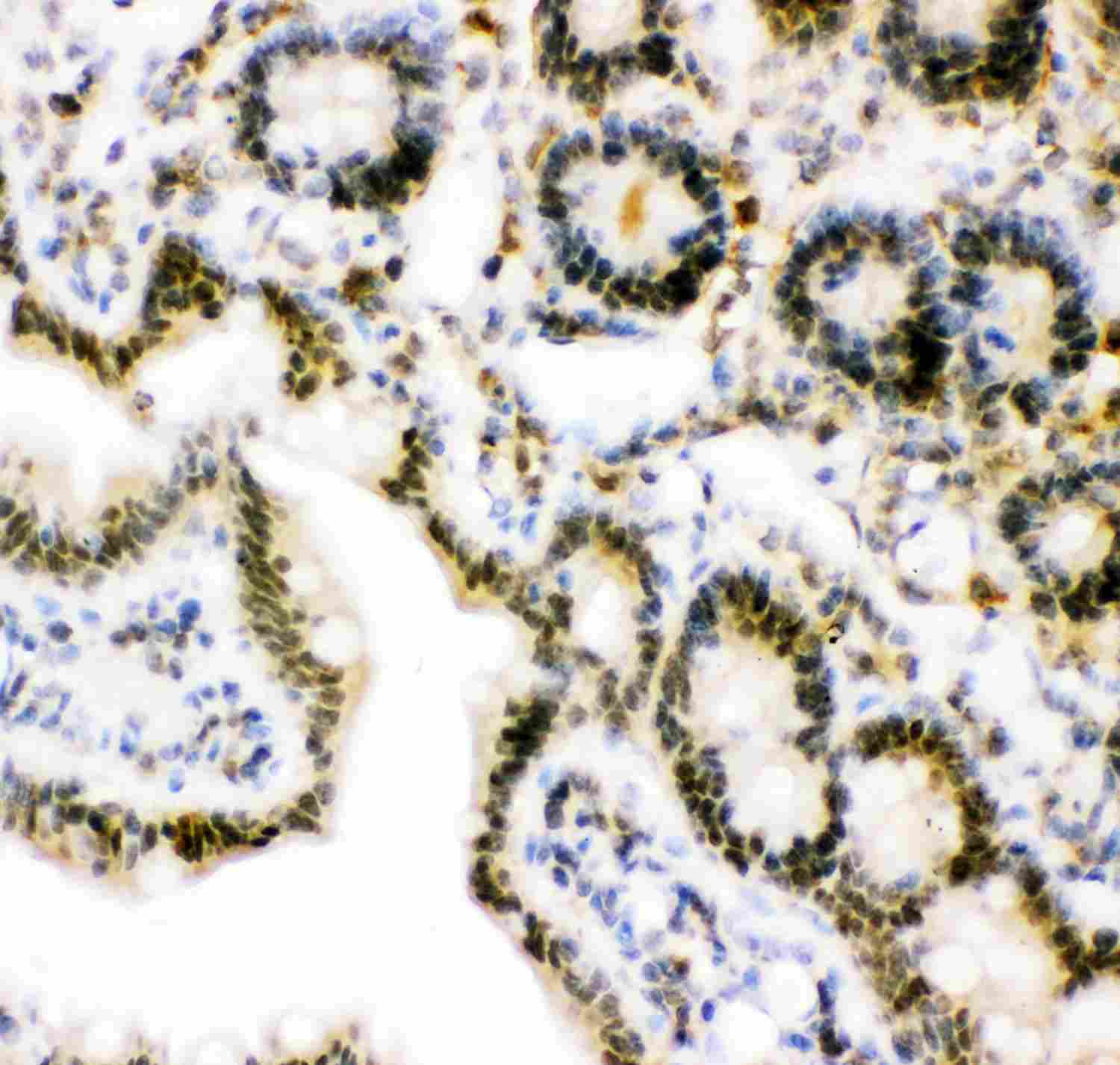 2 - Anti-Ubiquitin Picoband Antibody ABO11824