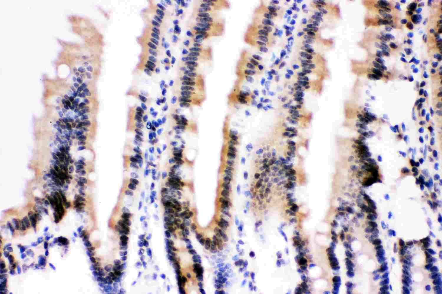 2 - Anti-Ubiquitin Picoband Antibody ABO11824