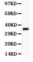 1 - Anti-Ubiquitin Picoband Antibody ABO11824
