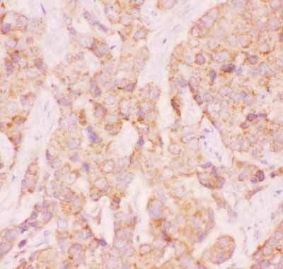 2 - Anti-AAMP Picoband Antibody ABO11825