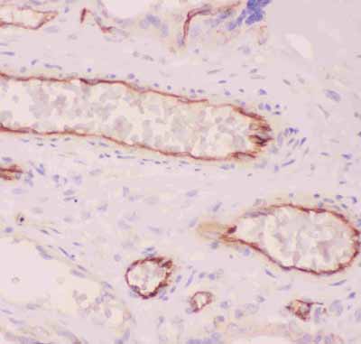2 - Anti-ACE Picoband Antibody ABO11826