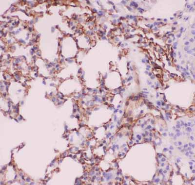 2 - Anti-ACE Picoband Antibody ABO11826