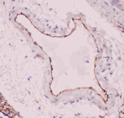 2 - Anti-ACE Picoband Antibody ABO11826