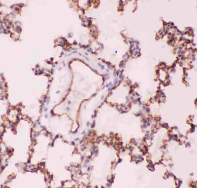 2 - Anti-ACE Picoband Antibody ABO11826
