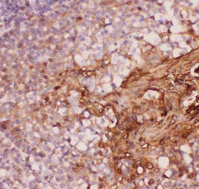 2 - Anti-Annexin A1 Picoband Antibody ABO11828