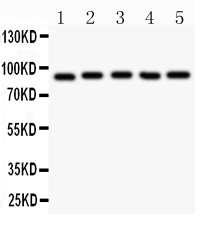 1 - Anti-HIF1 Beta Picoband Antibody ABO11830