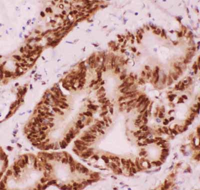 2 - Anti-ATF2 Picoband Antibody ABO11832