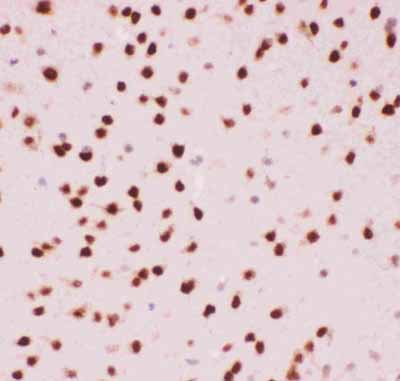 2 - Anti-ATF2 Picoband Antibody ABO11832