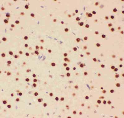 2 - Anti-ATF2 Picoband Antibody ABO11832