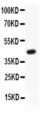 1 - Anti-ATF2 Picoband Antibody ABO11832