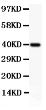 1 - Anti-MCL1 Picoband Antibody ABO11833