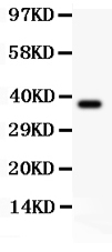 1 - Anti-Bmi1 Picoband Antibody ABO11834