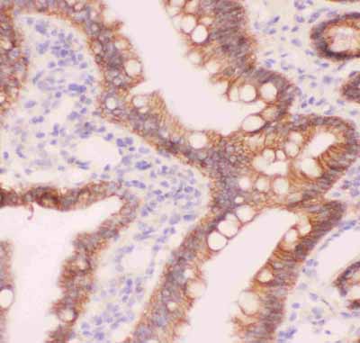 2 - Anti-CTNNA1 Picoband Antibody ABO11838