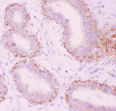 2 - Anti-CTNNA1 Picoband Antibody ABO11838