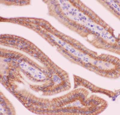 2 - Anti-CTNNA1 Picoband Antibody ABO11838