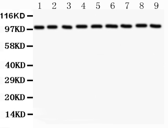 1 - Anti-CTNNA1 Picoband Antibody ABO11838