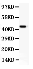 1 - Anti-CD11b Picoband Antibody ABO11839