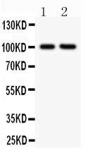 2 - Anti-CD18 Picoband Antibody ABO11840