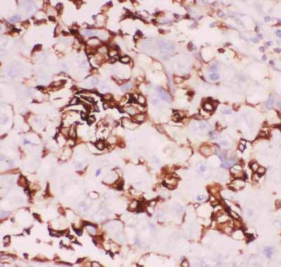 2 - Anti-CD18 Picoband Antibody ABO11840