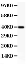 1 - Anti-CD18 Picoband Antibody ABO11840