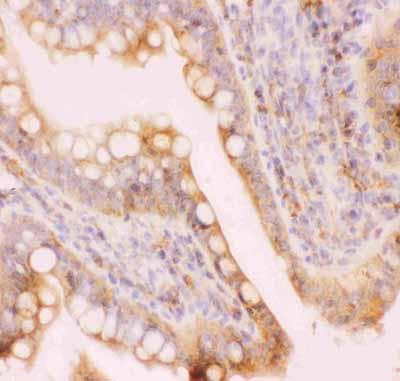 2 - Anti-MRP4 Picoband Antibody ABO11843