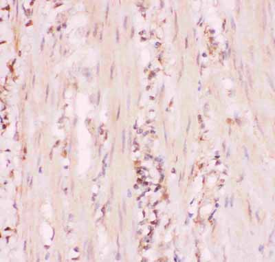 2 - Anti-MRP4 Picoband Antibody ABO11843