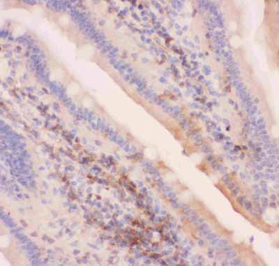 2 - Anti-MRP4 Picoband Antibody ABO11843