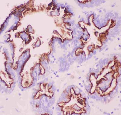2 - Anti-MUC1 Picoband Antibody ABO11844