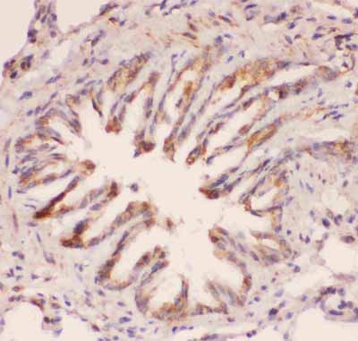 2 - Anti-MyD88 Picoband Antibody ABO11846
