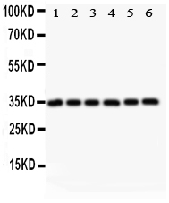 1 - Anti-MyD88 Picoband Antibody ABO11846