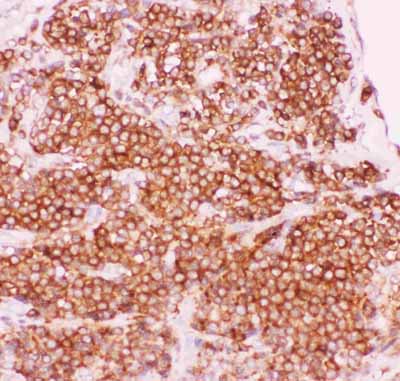 2 - Anti-NFkB p105/P50 Picoband Antibody ABO11847