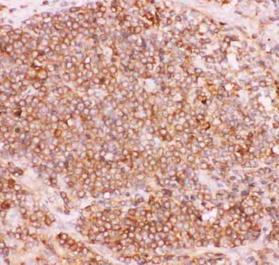 2 - Anti-NFkB p100/p52 Picoband Antibody ABO11848