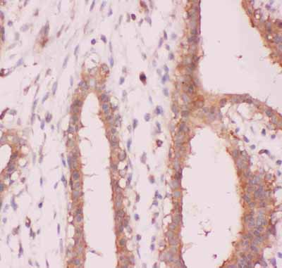 2 - Anti-NFkB p100/p52 Picoband Antibody ABO11848
