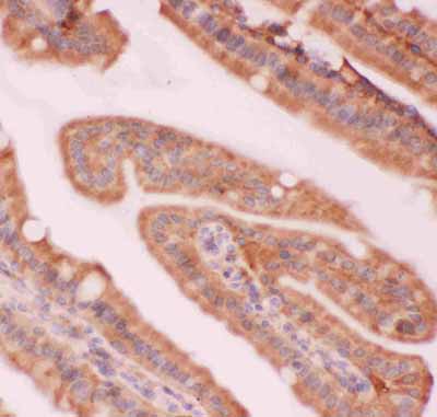 2 - Anti-NFkB p100/p52 Picoband Antibody ABO11848