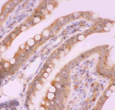 2 - Anti-NFkB p100/p52 Picoband Antibody ABO11848