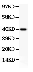 1 - Anti-NFkB p100/p52 Picoband Antibody ABO11848