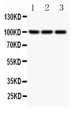 1 - Anti-NFkB p100/p52 Picoband Antibody ABO11848