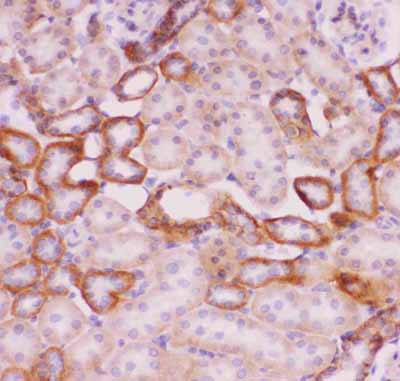 2 - Anti-SLC9A1 Picoband Antibody ABO11849