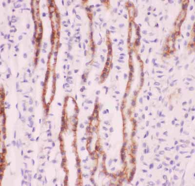 2 - Anti-SLC9A1 Picoband Antibody ABO11849