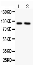 1 - Anti-SLC9A1 Picoband Antibody ABO11849