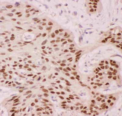 2 - Anti-p63 Picoband Antibody ABO11850