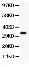 1 - Anti-PD-L1/B7-H1 Antibody ABO11851