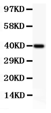 1 - Anti-Perforin Picoband Antibody ABO11852